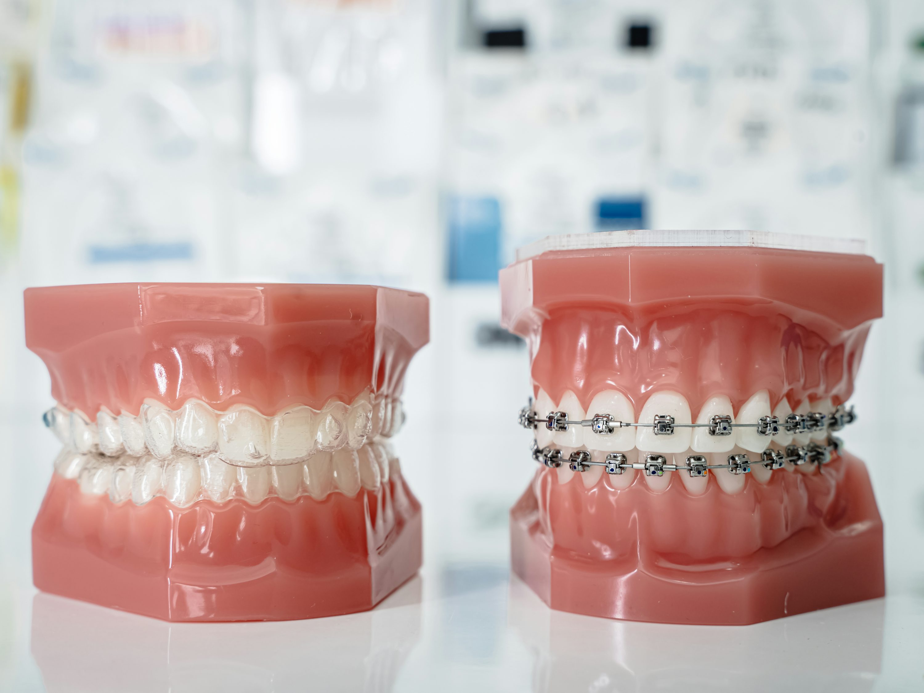 braces