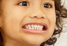 child-dental-care after result