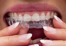 braces after result
