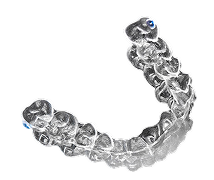 clear-aligners