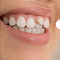 Teeth Move Gradually