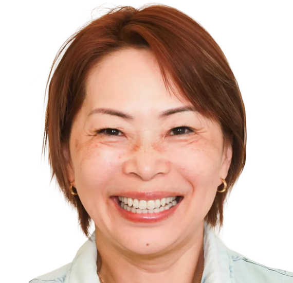Dental implant after result