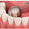 Consultation & Scan