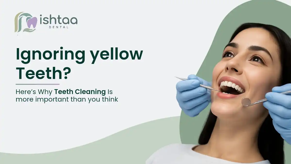 ingoring-yellow