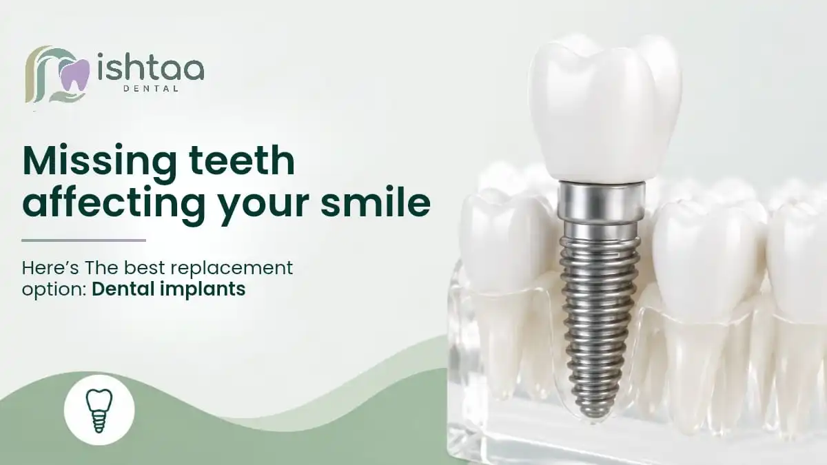 missing-teeth