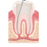 Infection Removed