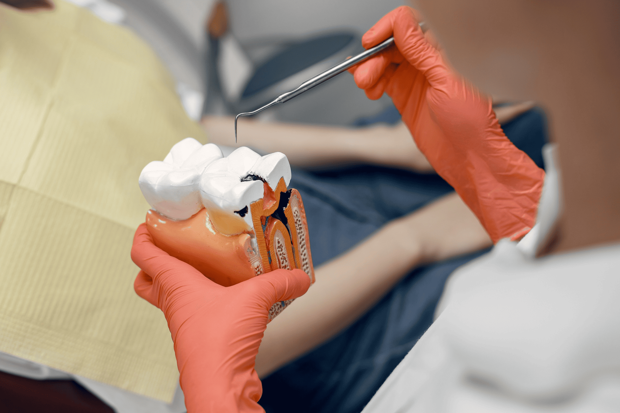 root-canal02