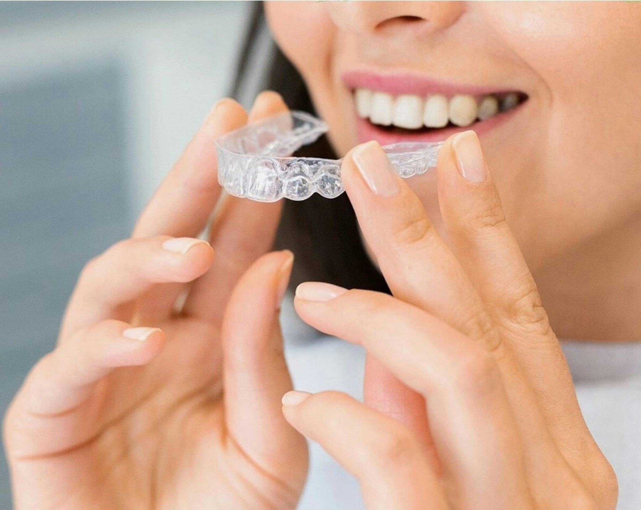 clear-aligners