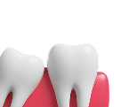 clear-aligners